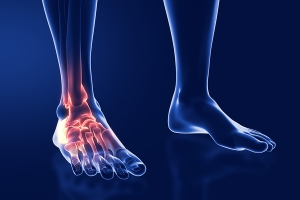 Understanding Upper Extremity Fragility Fractures: A Growing Concern in the Elderly